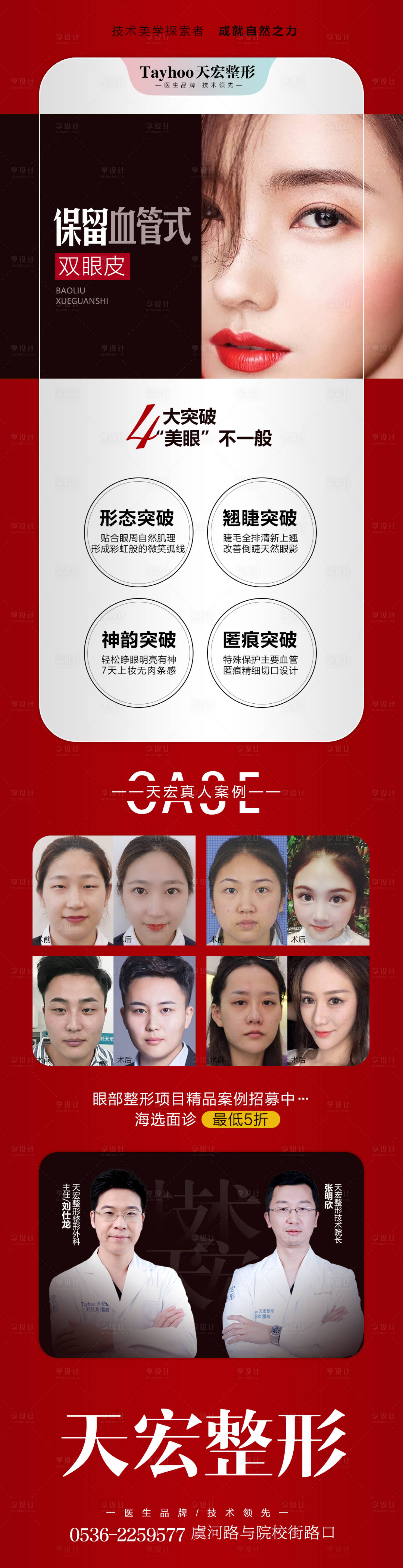 源文件下载【双眼皮整形长图】编号：21400014627788629