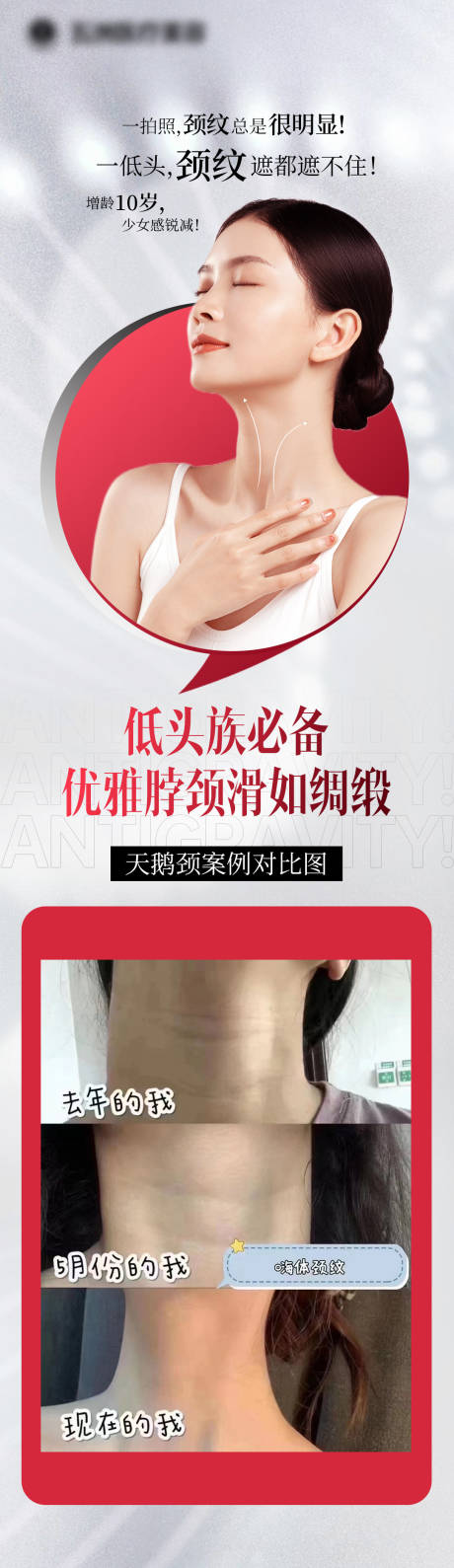 源文件下载【享设计】搜索编号：86660014538334649【祛颈纹案例海报】