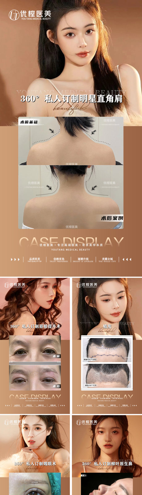 源文件下载【医美案例对比人物系列海报】编号：28960014601816255