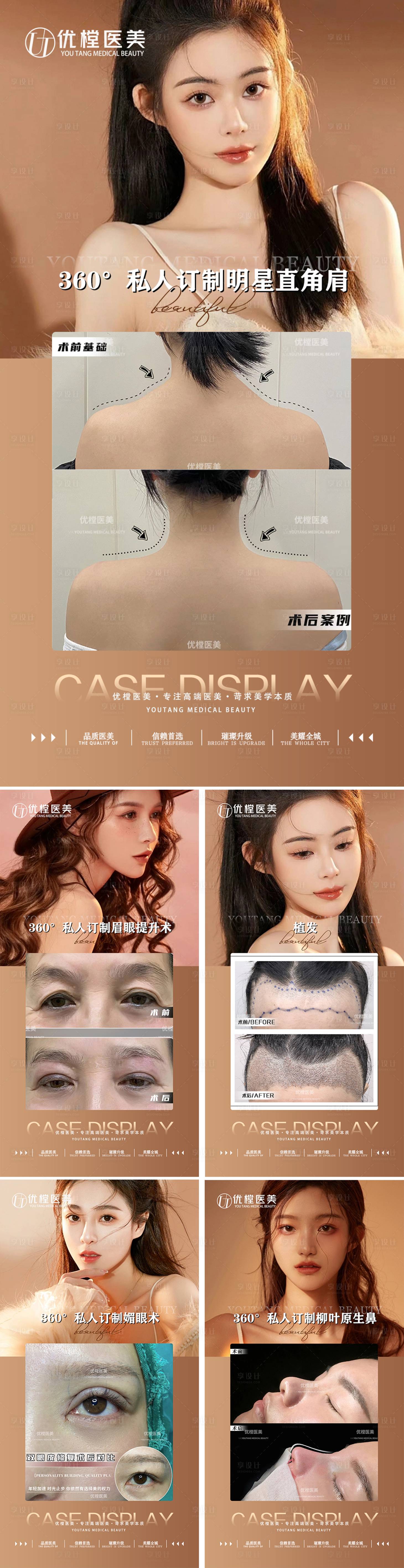 源文件下載【享設計】搜索編號：28960014601816255【醫美案例對比人物系列海報】