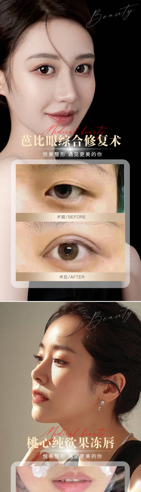 源文件下载【享设计】搜索编号：87090014898615001【医美案例对比图海报】
