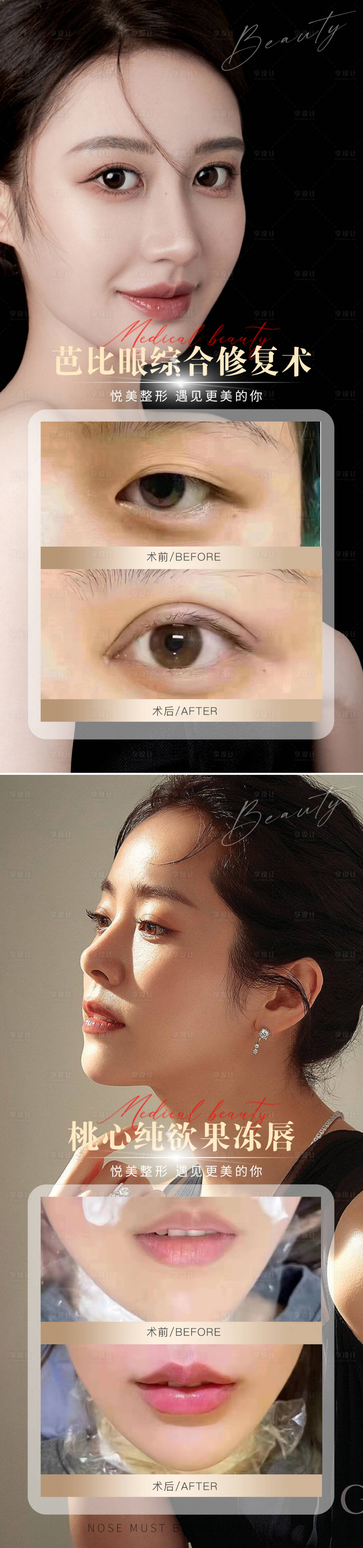 源文件下载【享设计】搜索编号：87090014898615001【医美案例对比图海报】