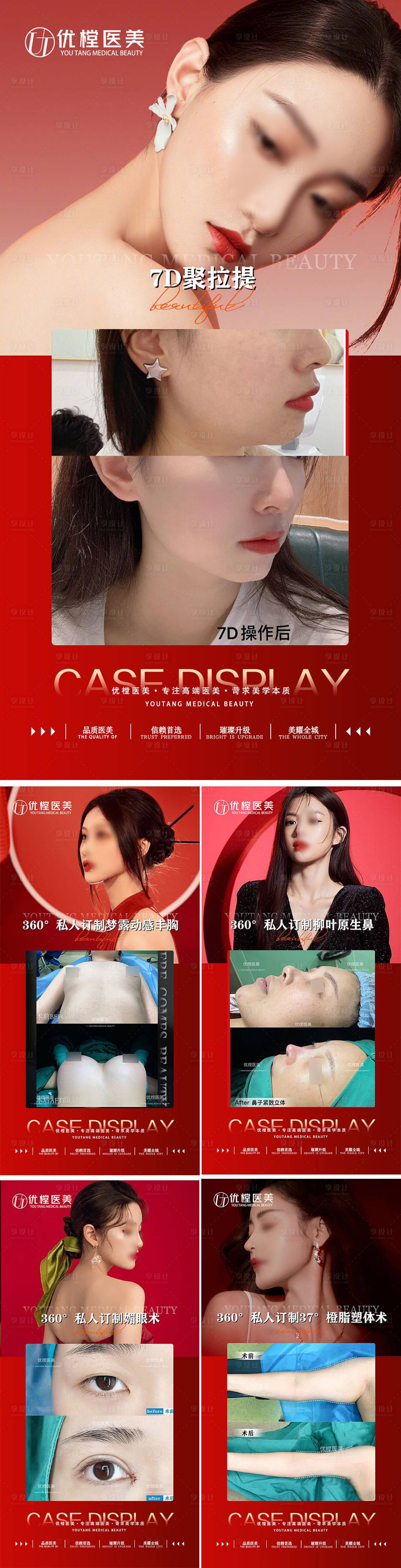源文件下载【享设计】搜索编号：88200014471994593【医美案例对比海报】