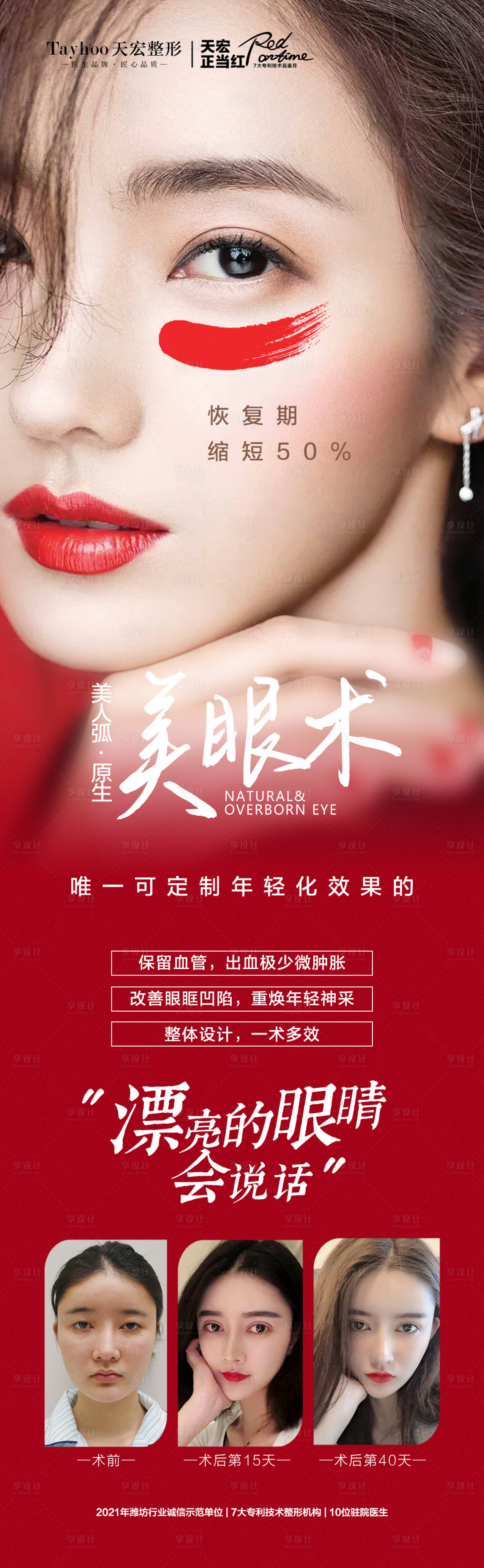 源文件下載【享設計】搜索編號：11110014721519695【醫美天宏雙眼皮重瞼術長圖海報】