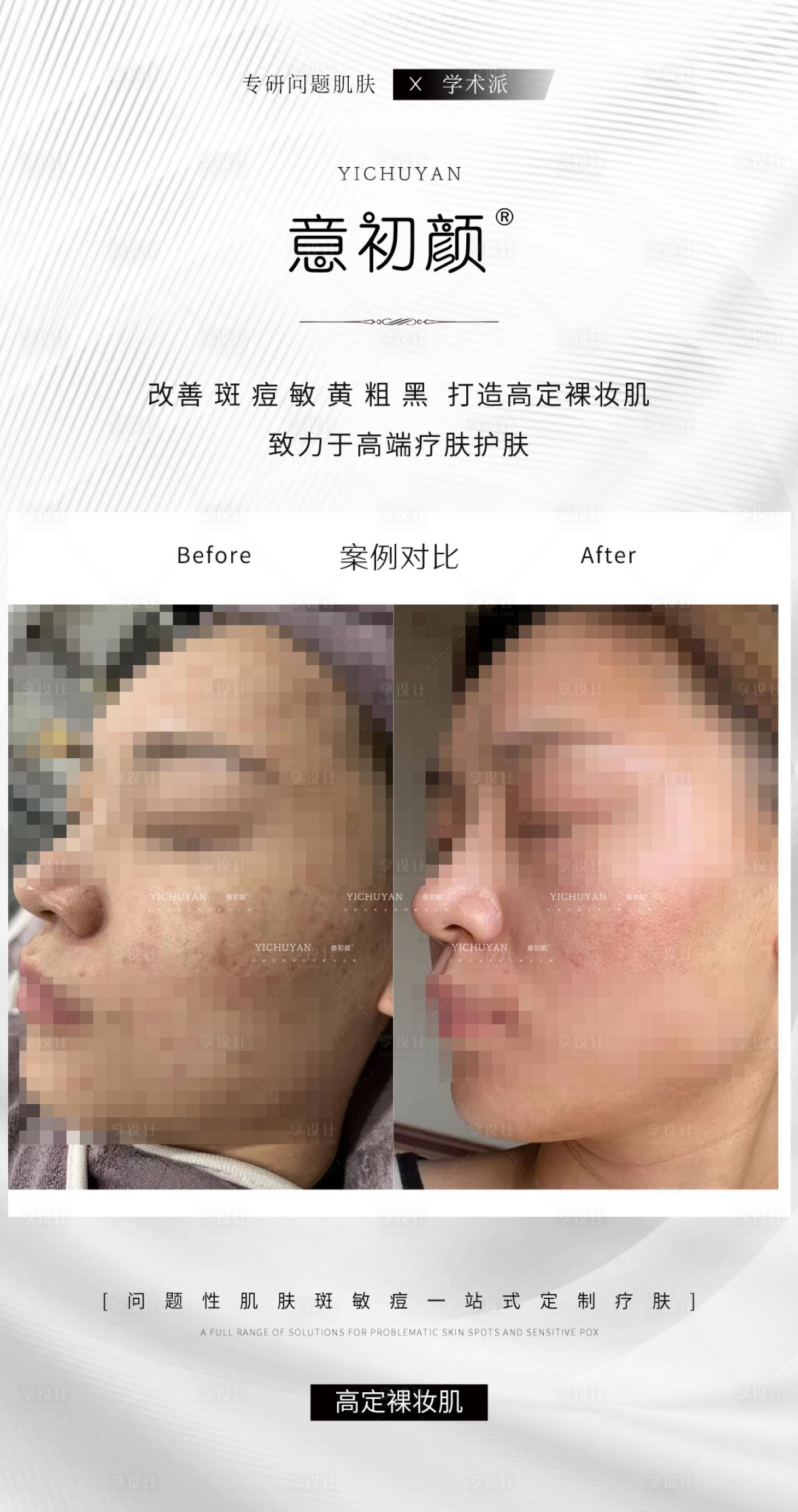 源文件下載【享設(shè)計(jì)】搜索編號(hào)：34050014813286485【長(zhǎng)沙醫(yī)美美容祛斑美白痘痘模特對(duì)比簡(jiǎn)約】