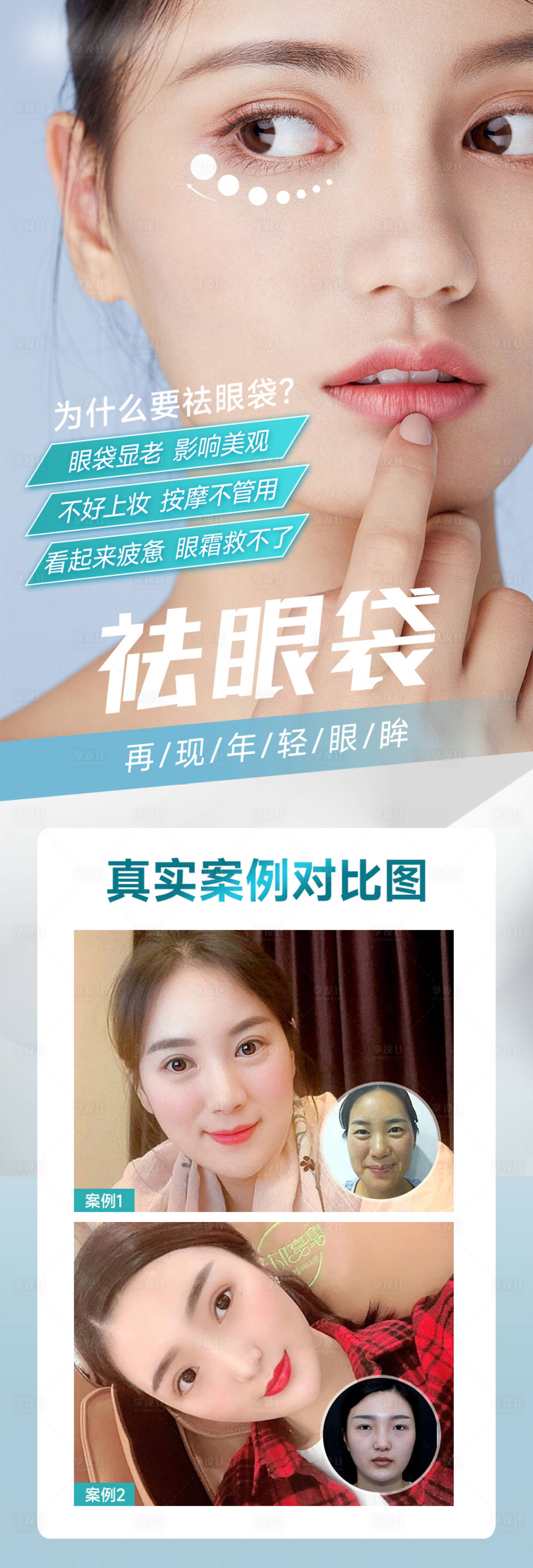 源文件下載【享設計】搜索編號：98570014560189078【祛眼袋案例海報】
