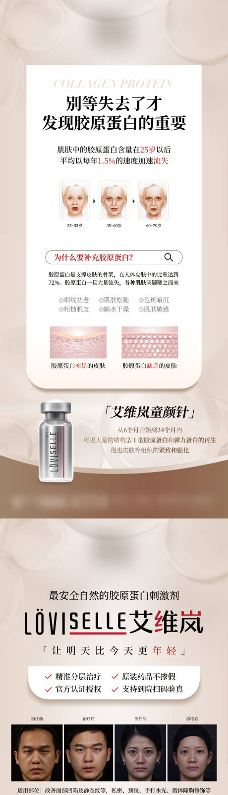 源文件下载【医美艾维岚产品海报】编号：55960014606298764