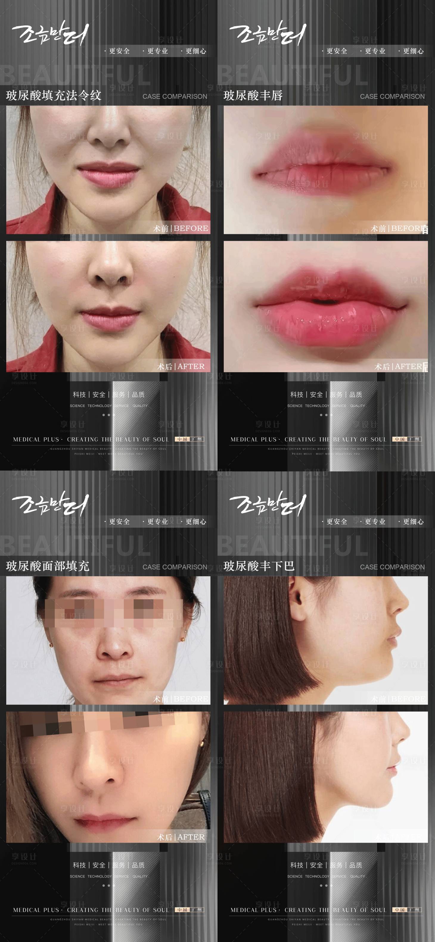 源文件下載【享設(shè)計(jì)】搜索編號(hào)：75280014971239959【醫(yī)美玻尿酸案例對(duì)比】
