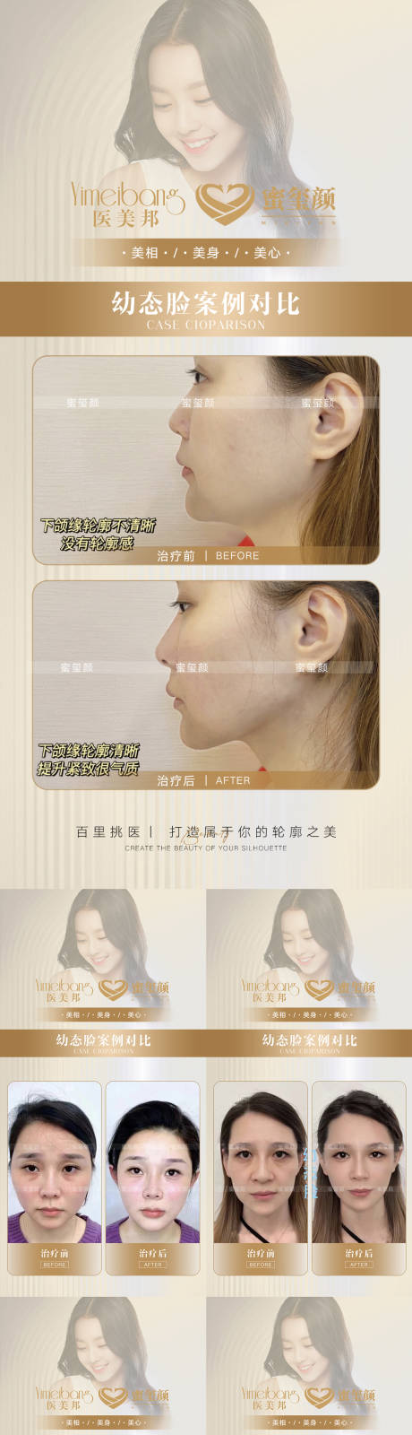 源文件下载【享设计】搜索编号：20850015355633109【医美幼态脸案例对比5组】