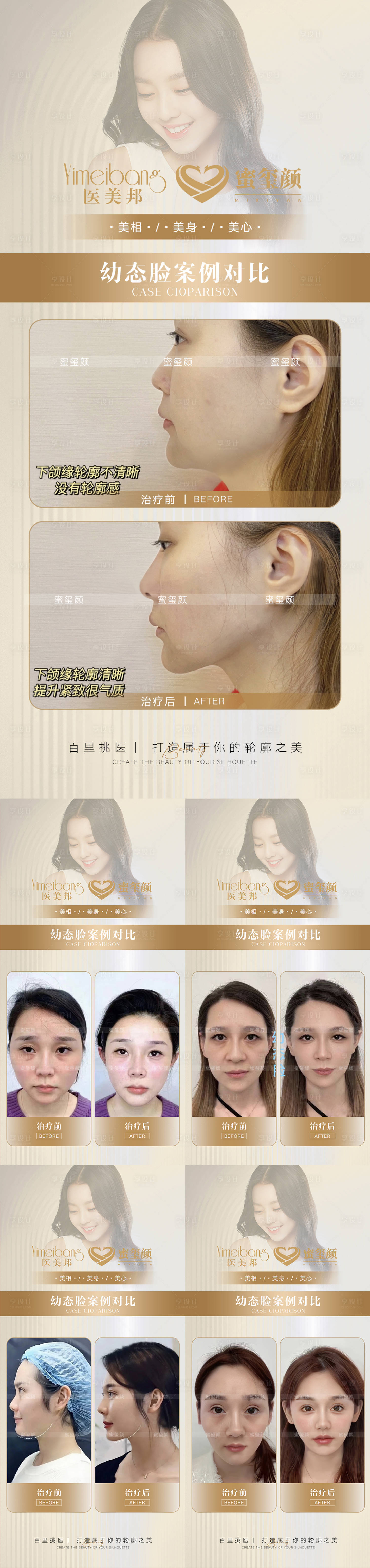 源文件下载【享设计】搜索编号：20850015355633109【医美幼态脸案例对比5组】