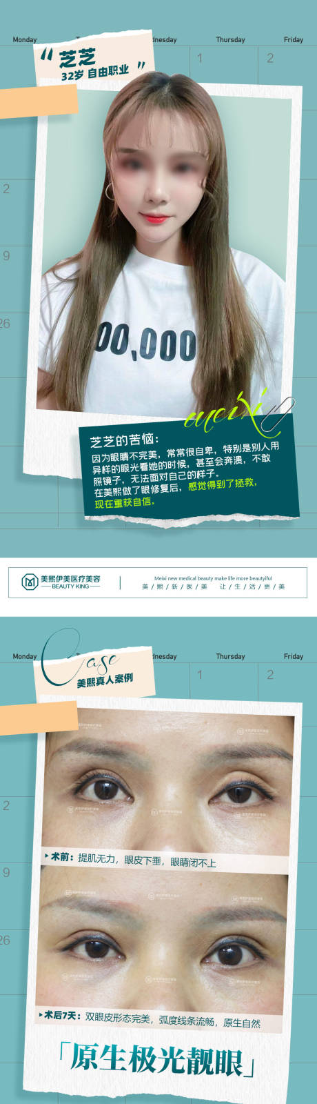源文件下載【享設(shè)計(jì)】搜索編號(hào)：86370015376025484【醫(yī)美眼睛案例海報(bào)】