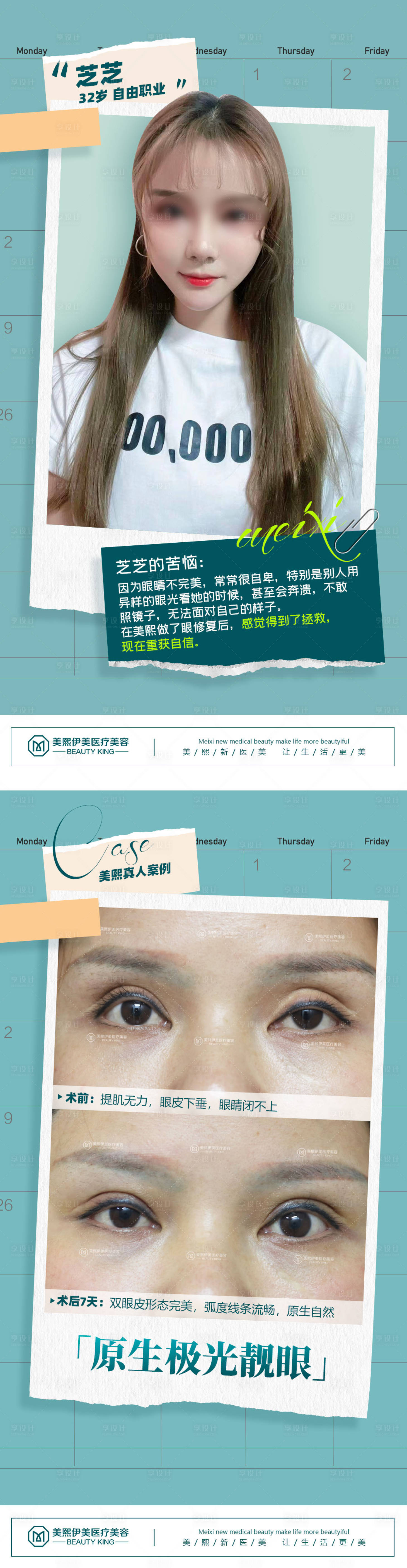 源文件下載【享設計】搜索編號：86370015376025484【醫美眼睛案例海報】