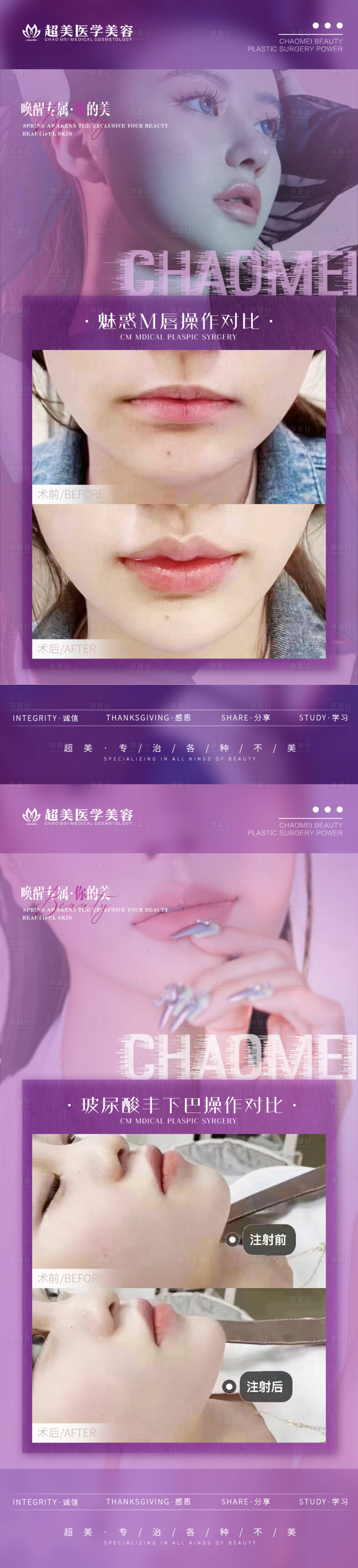 源文件下载【M唇玻尿酸下巴系列海报】编号：14560015671963113