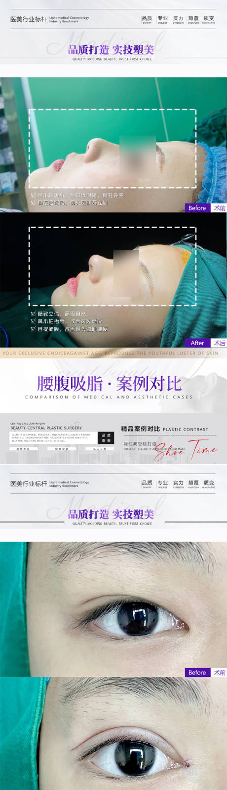 源文件下載【醫(yī)美眼鼻案例海報(bào)】編號(hào)：75410015470535645