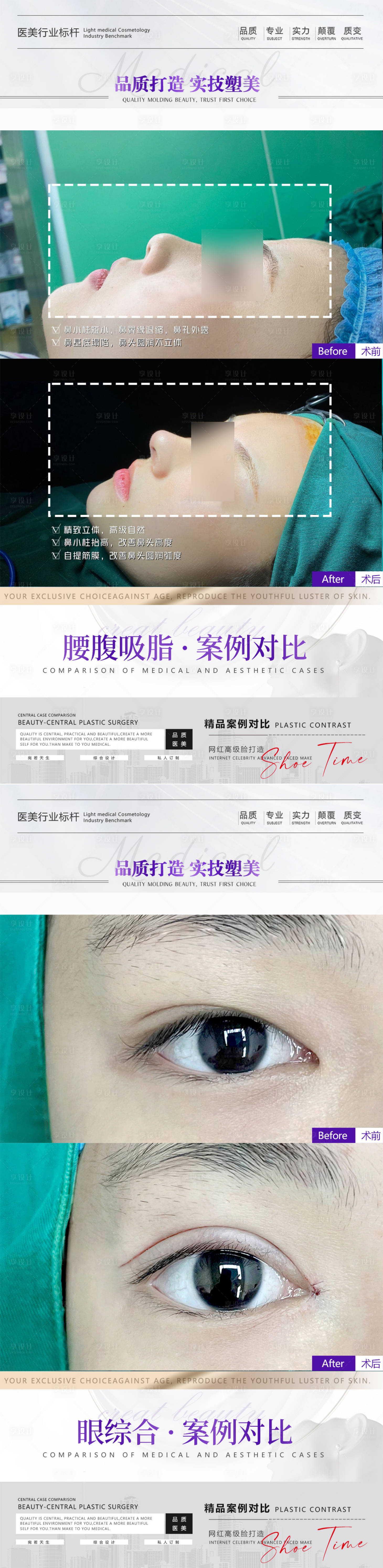 源文件下载【享设计】搜索编号：75410015470535645【医美眼鼻案例海报】