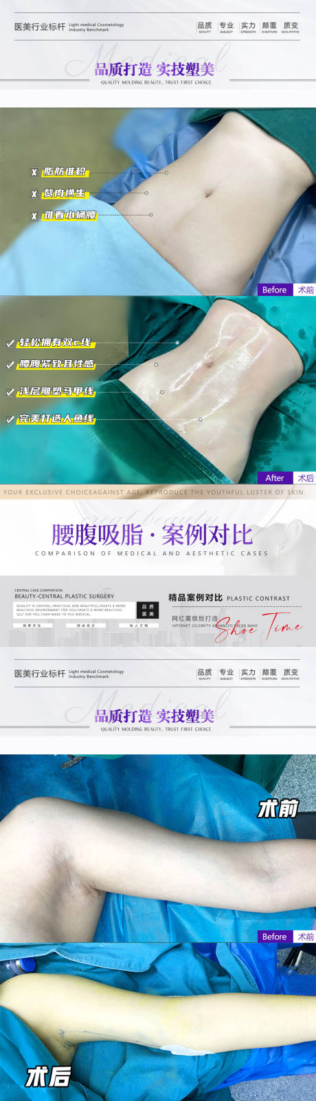源文件下载【医美案例系列海报】编号：36920015470496974