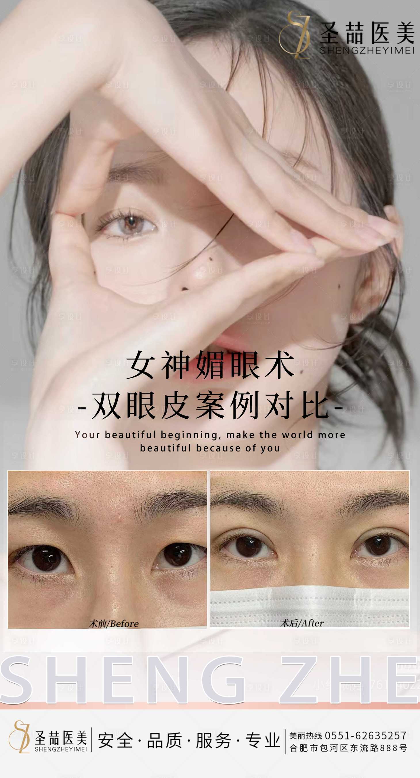源文件下载【享设计】搜索编号：42110015175319117【医美双眼皮海报 】