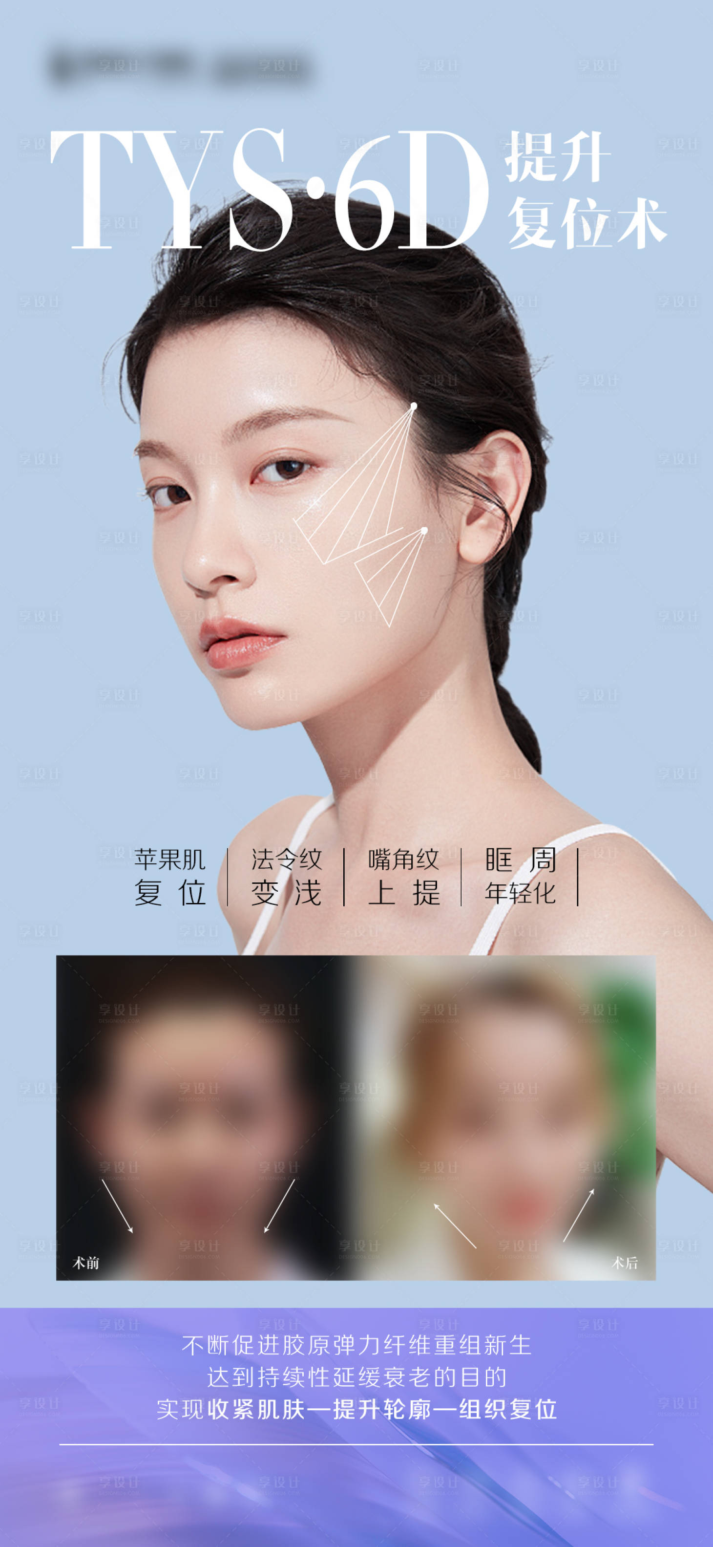 源文件下载【享设计】搜索编号：91910015709604201【医美线雕案例海报】