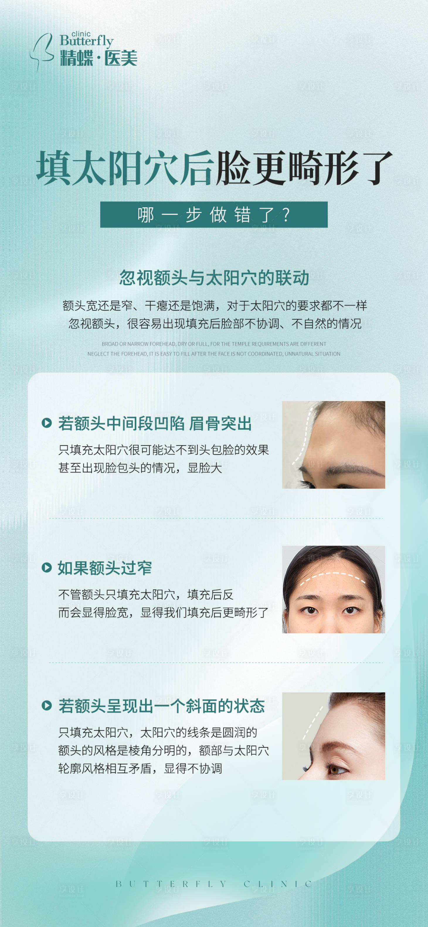 源文件下載【享設(shè)計】搜索編號：25530015447386482【高級感醫(yī)美太陽穴填充科普朋友圈海報】