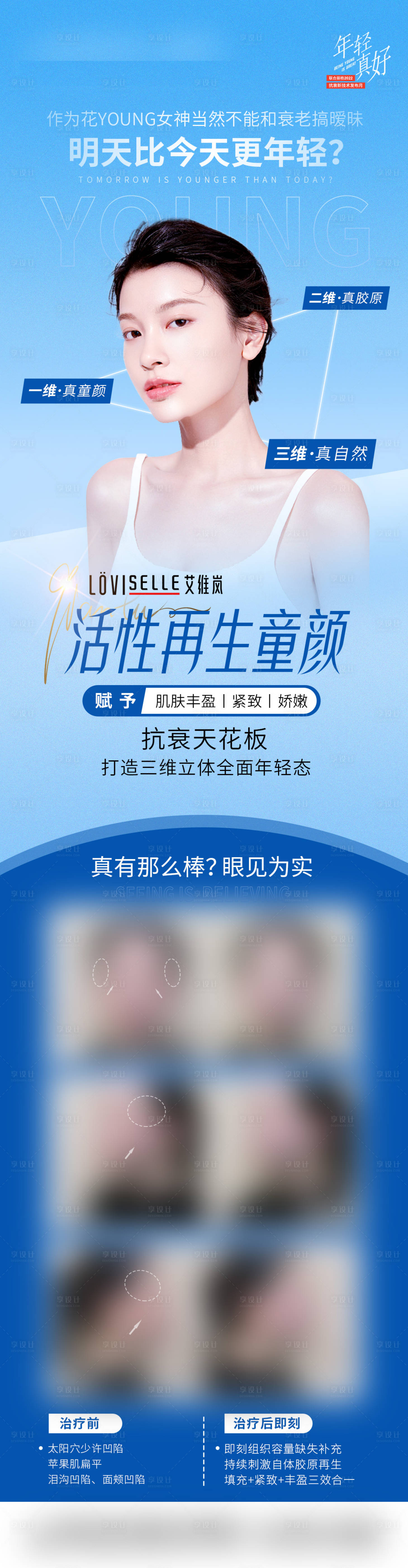 源文件下載【享設(shè)計】搜索編號：94080015277088430【童顏針醫(yī)美人物長圖海報】
