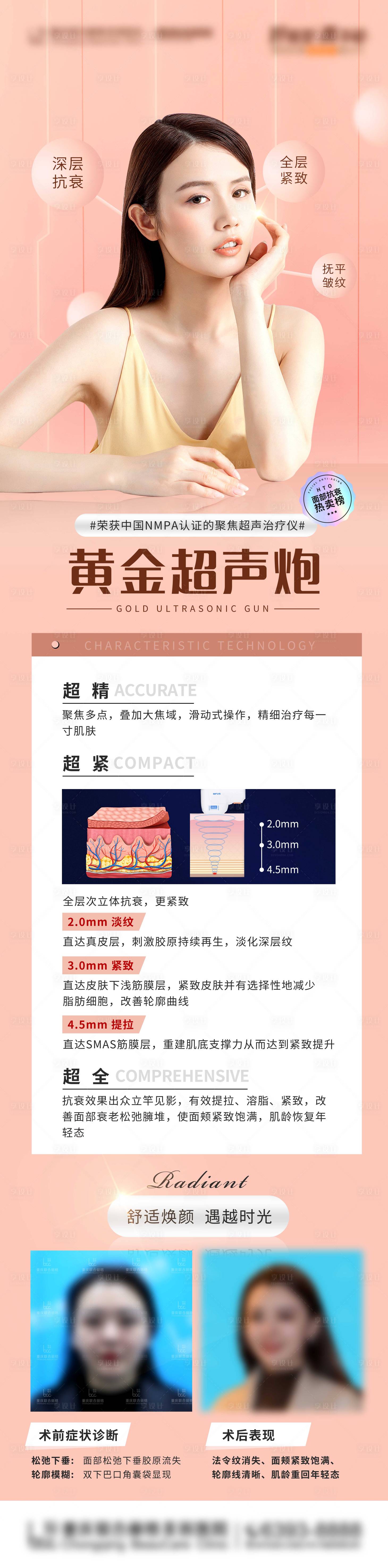 源文件下载【享设计】搜索编号：17480015276504368【超声炮功效海报长图】