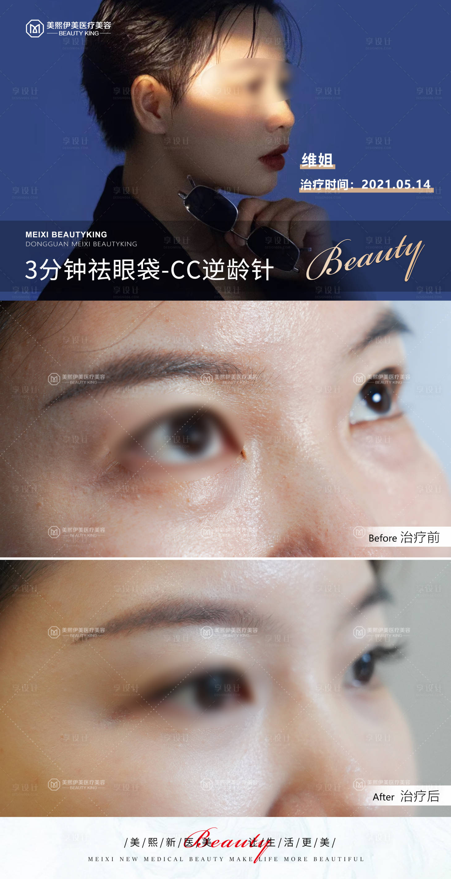 源文件下载【CC逆龄针】编号：79720015371557451