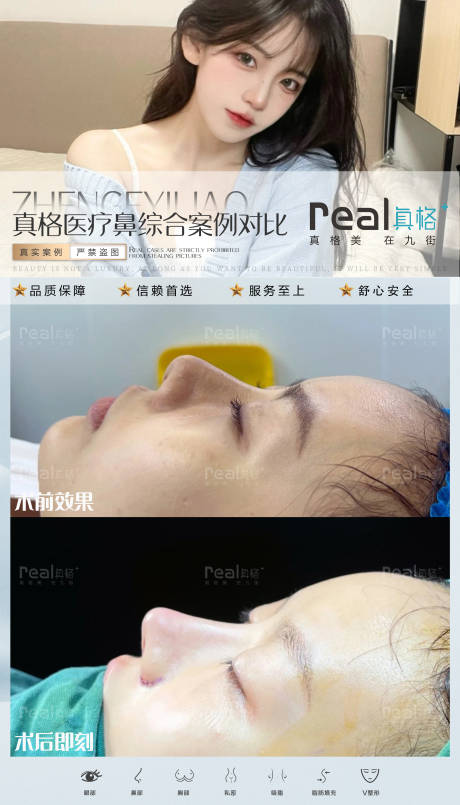 源文件下载【医美案例对比图】编号：59190015658053888