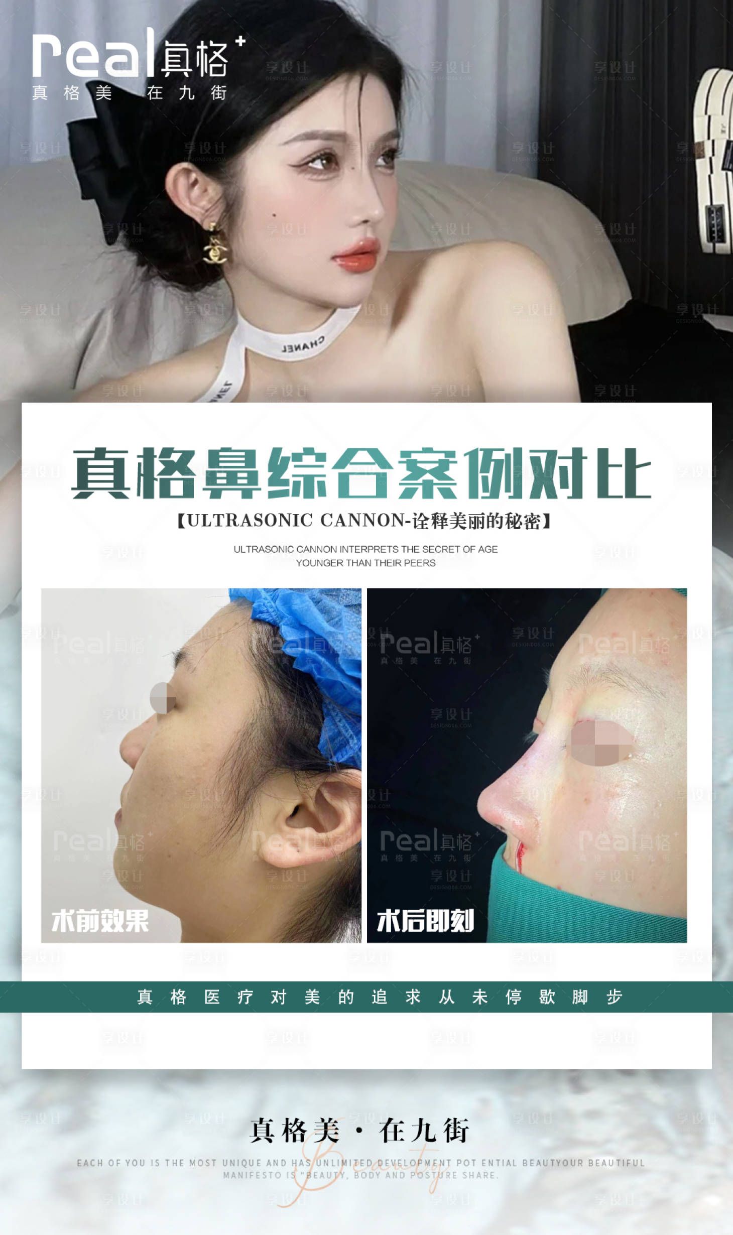 源文件下载【享设计】搜索编号：31960015657941800【医美案例对比图】