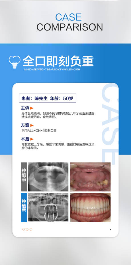 源文件下载【案例海报】编号：20230315093942578