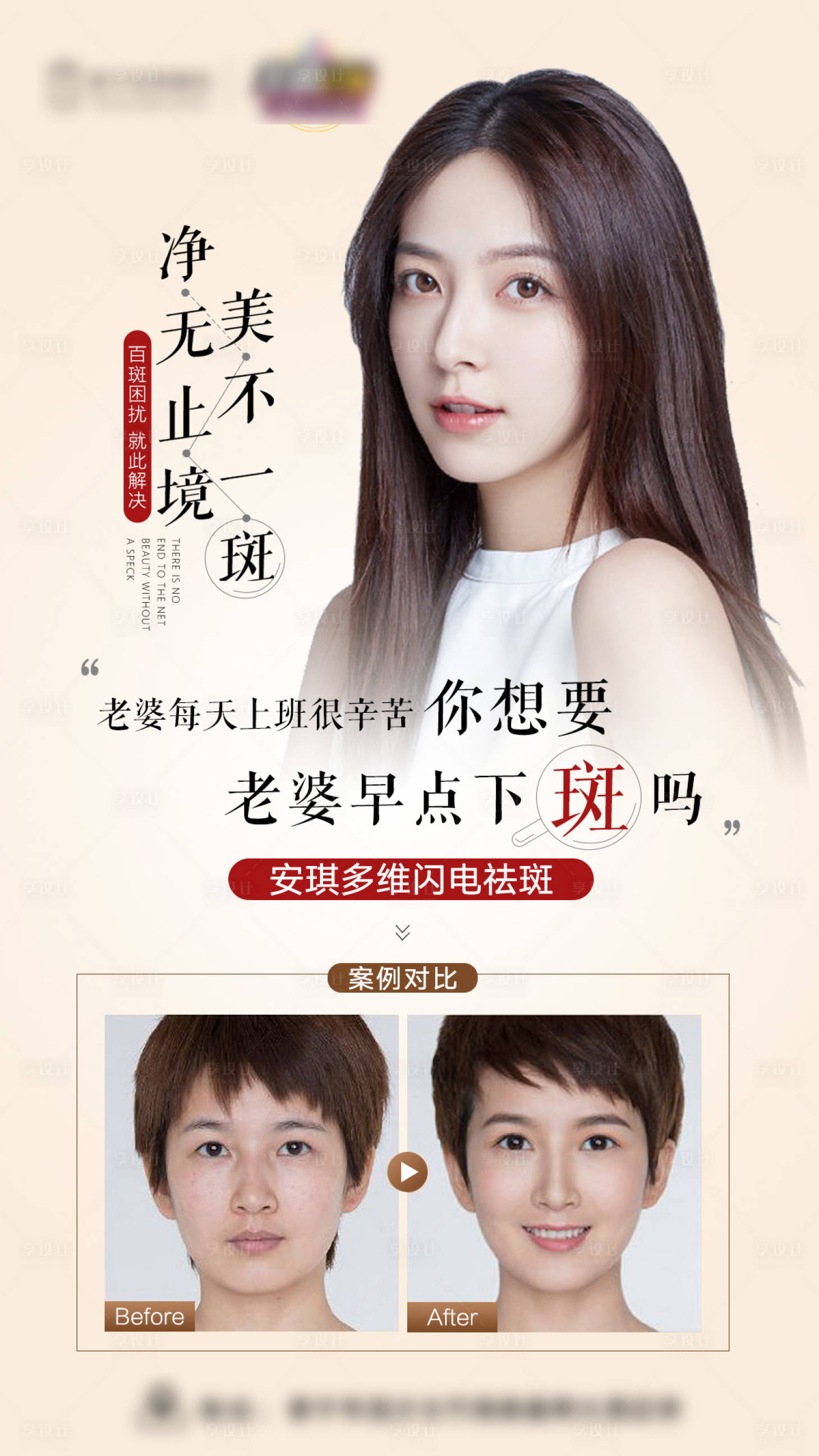 源文件下載【享設(shè)計(jì)】搜索編號(hào)：60440015333502705【醫(yī)美祛斑】