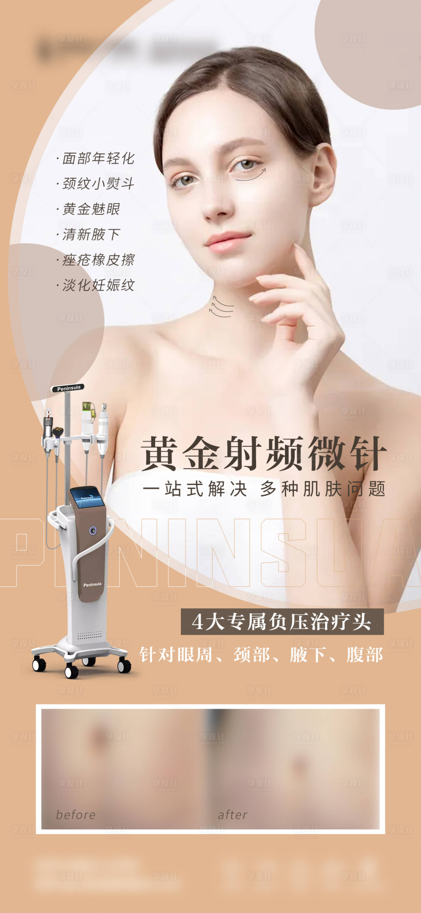 源文件下载【享设计】搜索编号：57240015700326452【医美黄金微针科普海报】