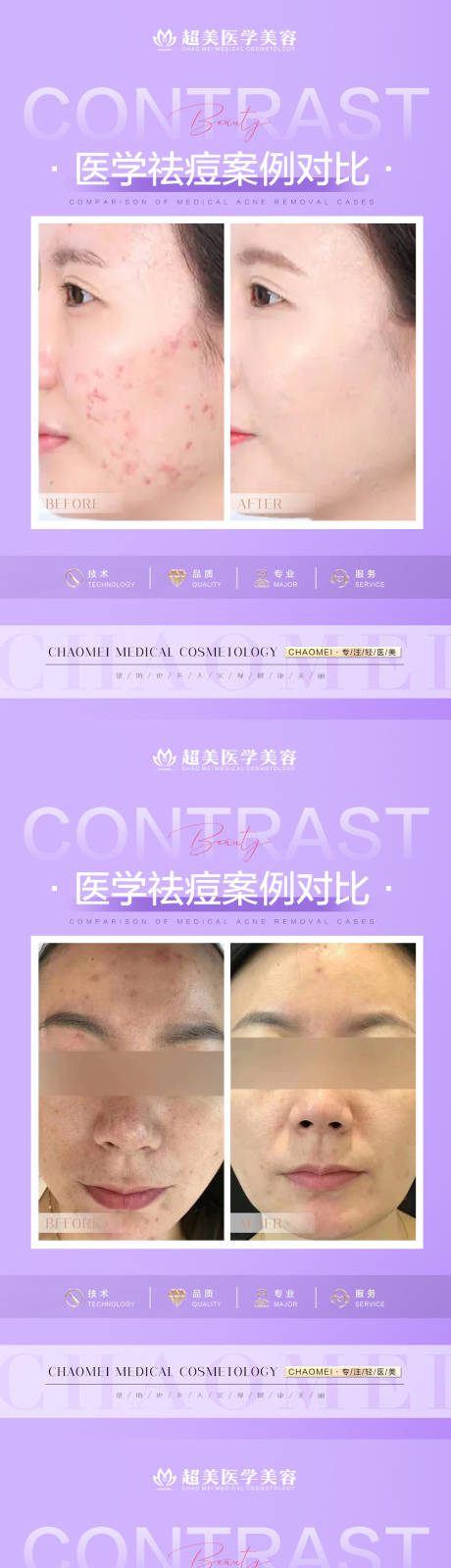 源文件下载【祛痘案例对比海报】编号：68800015380707521