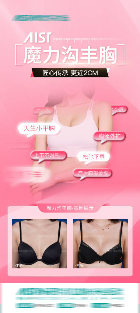 源文件下載【享設(shè)計(jì)】搜索編號(hào)：10190015401688932【隆胸案例海報(bào)】