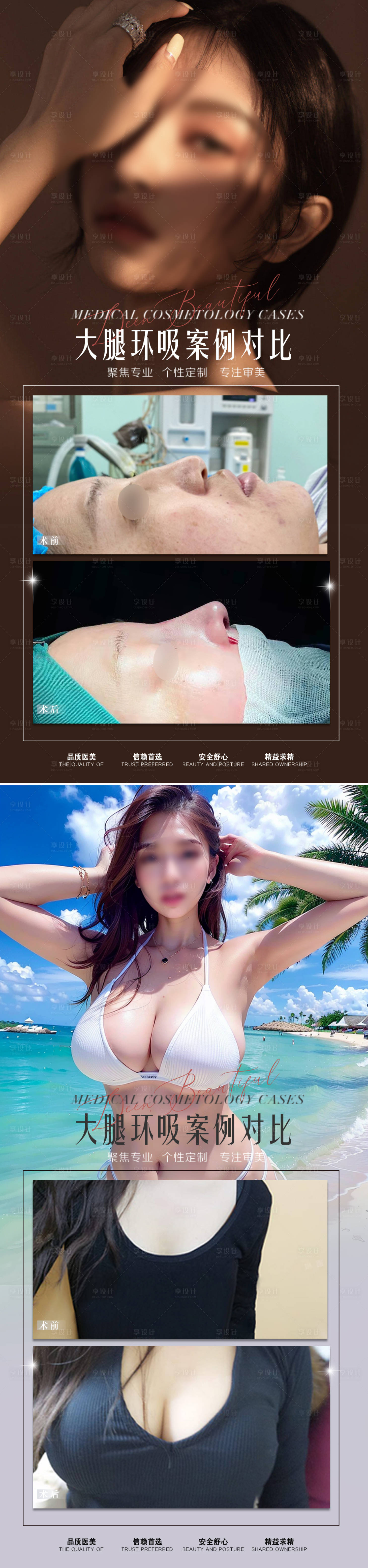 源文件下载【享设计】搜索编号：50320015372759050【整形真人案例对比系列海报】