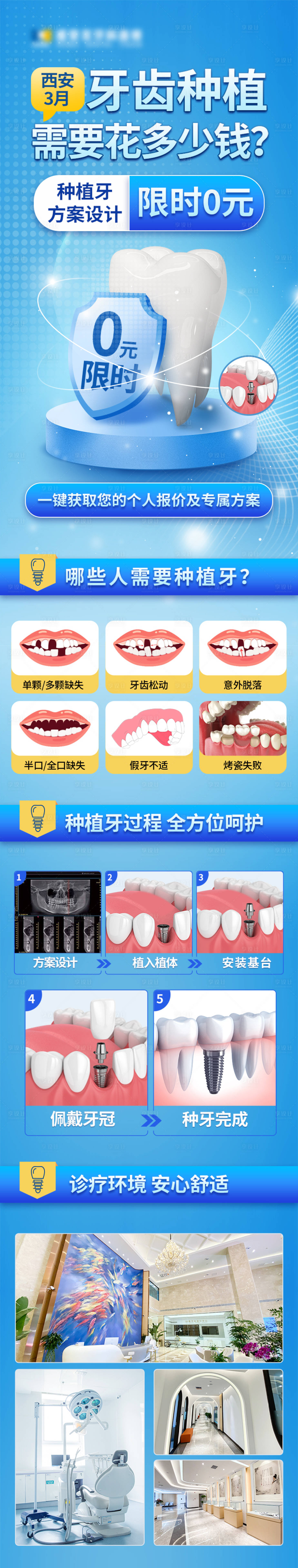 源文件下载【享设计】搜索编号：70650015186367053【口腔齿科美团种植牙电商详情页】