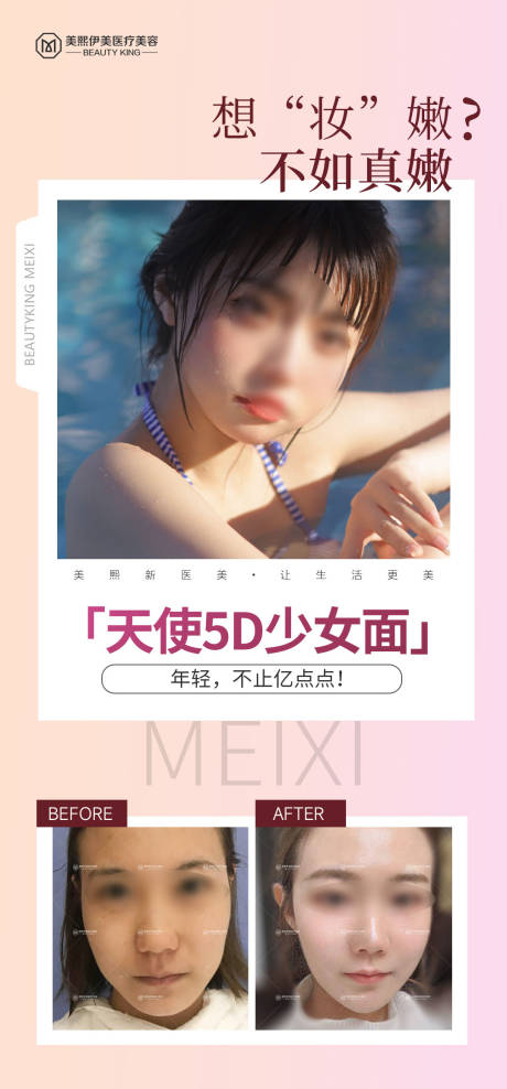 源文件下载【医美案例海报】编号：95100015379395347