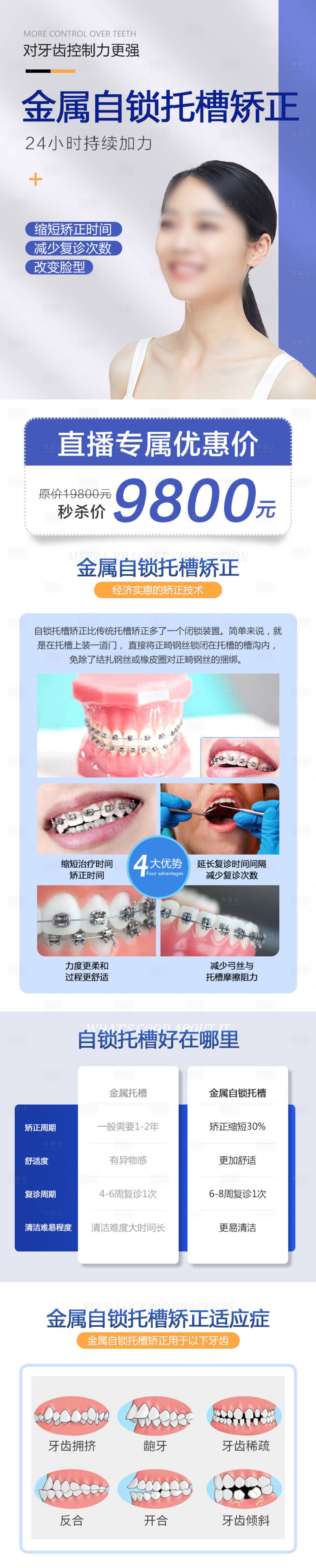源文件下载【享设计】搜索编号：92890015366364531【金属自锁托槽矫正海报长图】