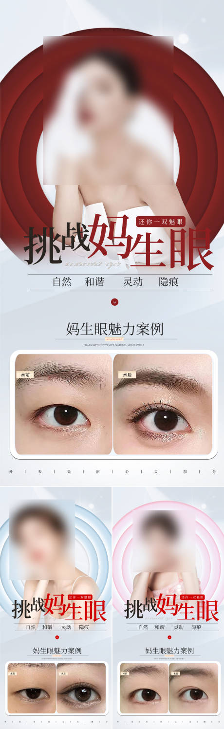 源文件下载【双眼皮案例海报】编号：73660015204899273