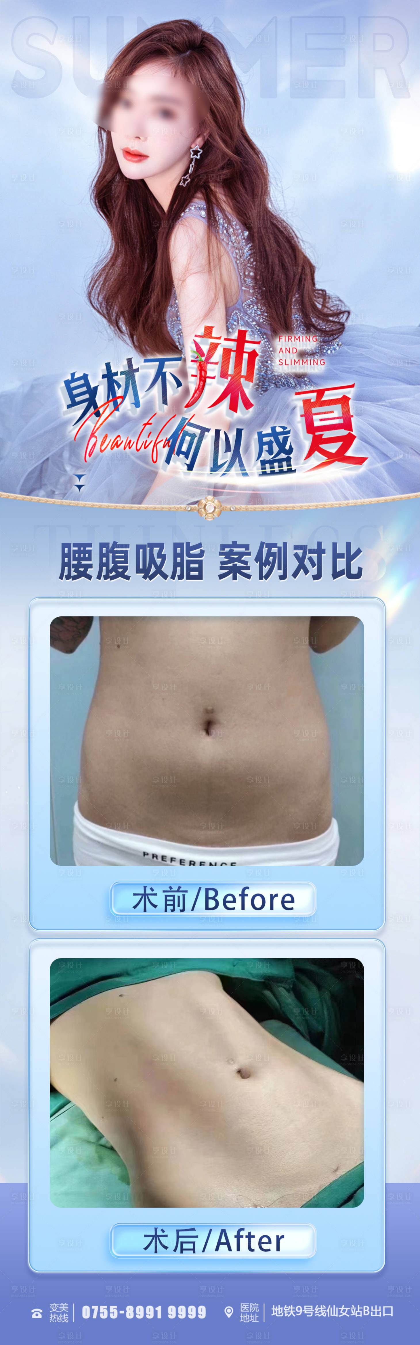 源文件下載【享設計】搜索編號：86320015676691588【醫美整形腰腹吸脂朋友圈案例海報】