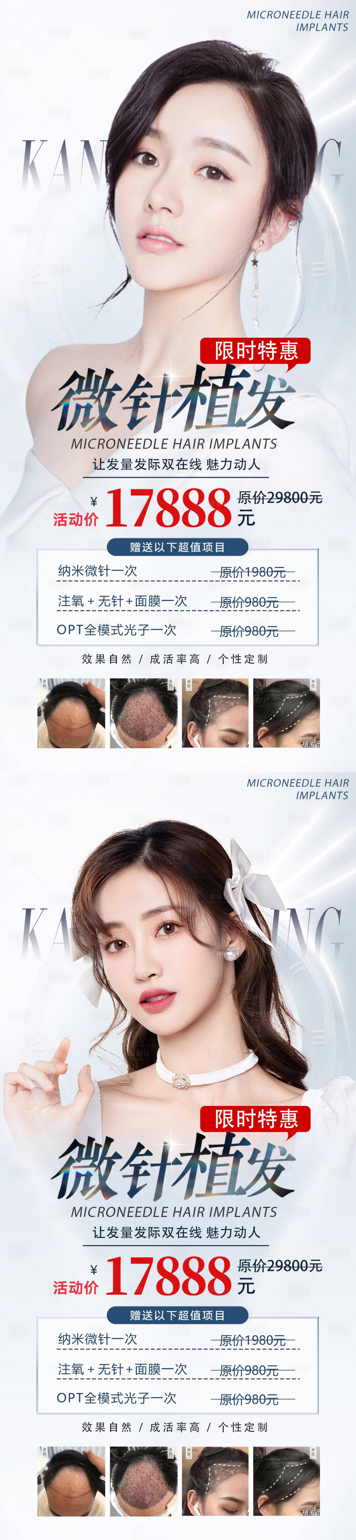 源文件下载【医美植发海报】编号：95760015516703975