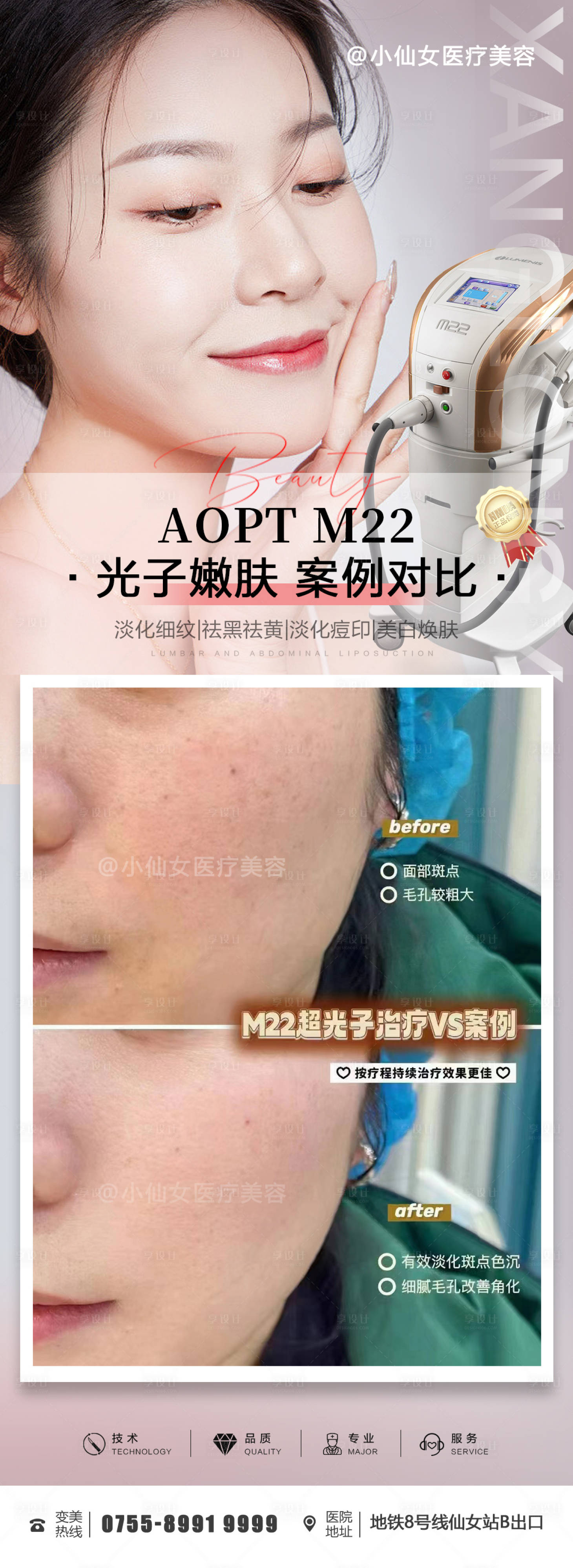 源文件下載【超光子嫩膚案例朋友圈海報】編號：18430015135009280