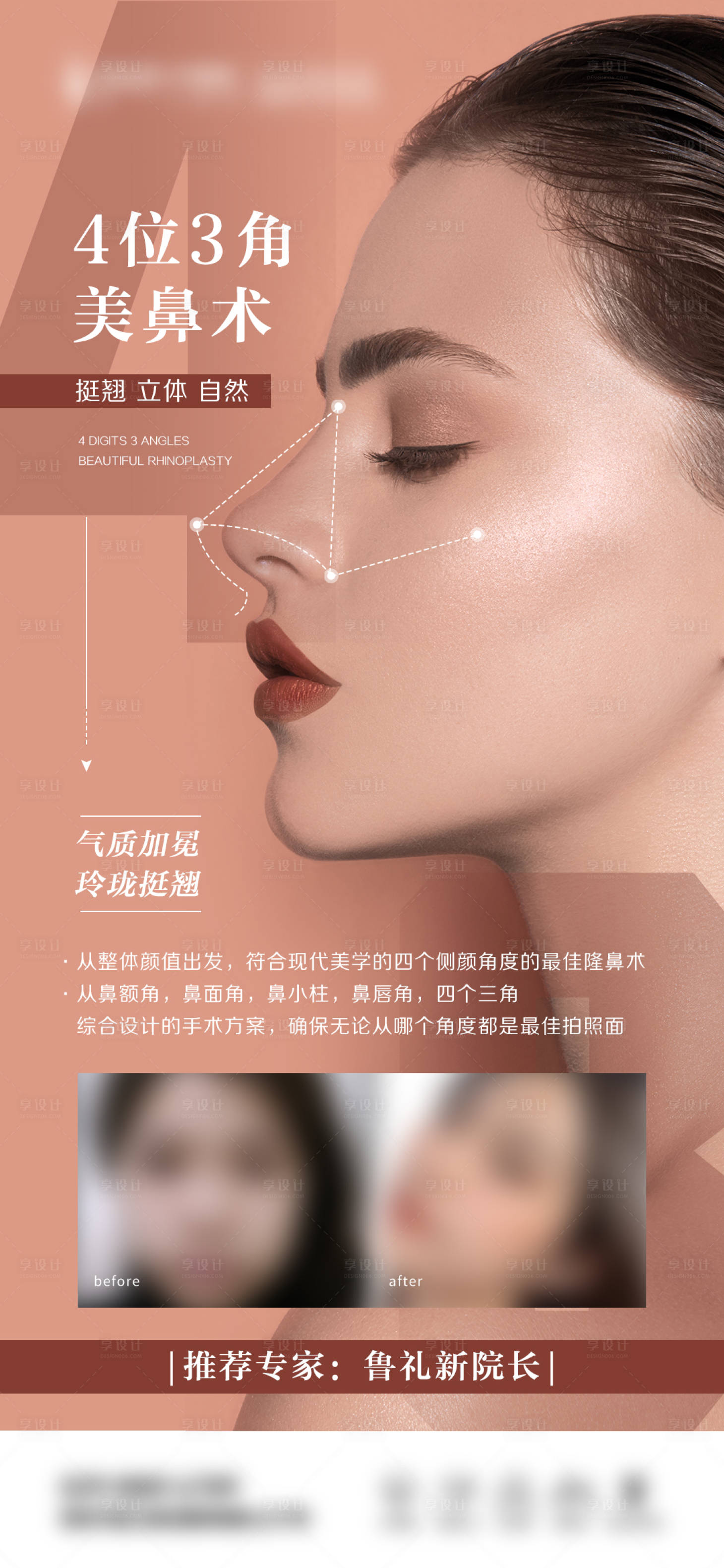 源文件下载【医美鼻子整形项目海报】编号：13160015700334132