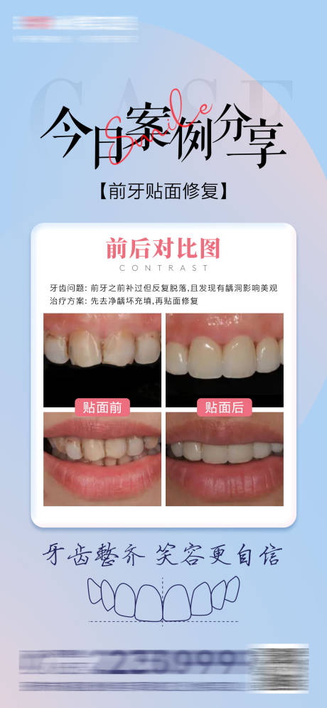 源文件下载【医美口腔案例分享对比海报】编号：97510015707867506