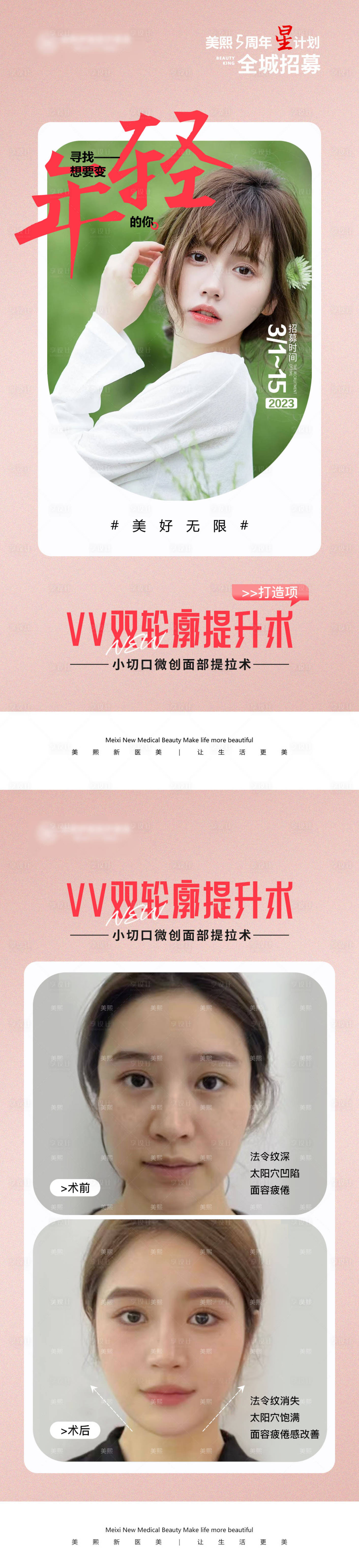 源文件下載【享設計】搜索編號：54680015337096323【VV雙輪廓提升招募】