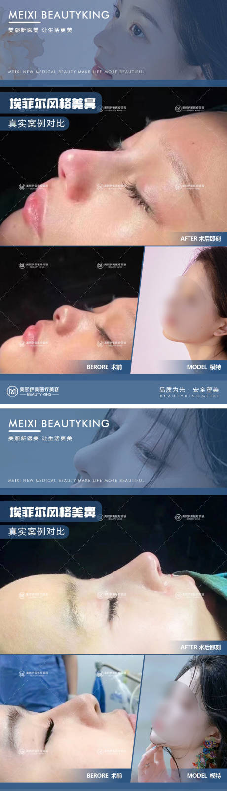 源文件下载【医美案例对比系列海报】编号：33510015380085027