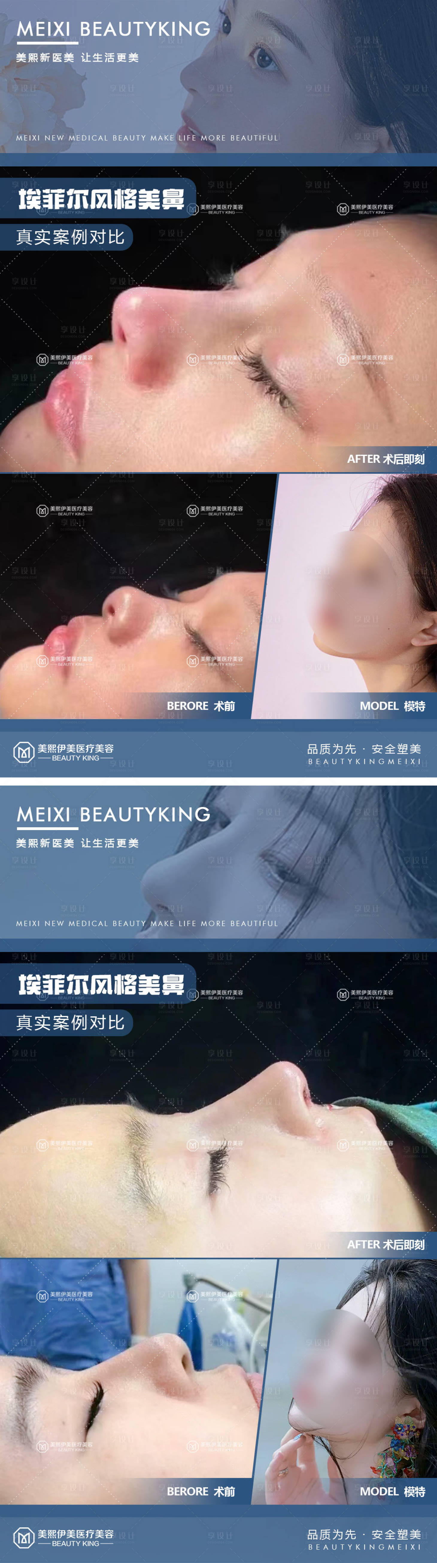源文件下载【医美案例对比系列海报】编号：33510015380085027