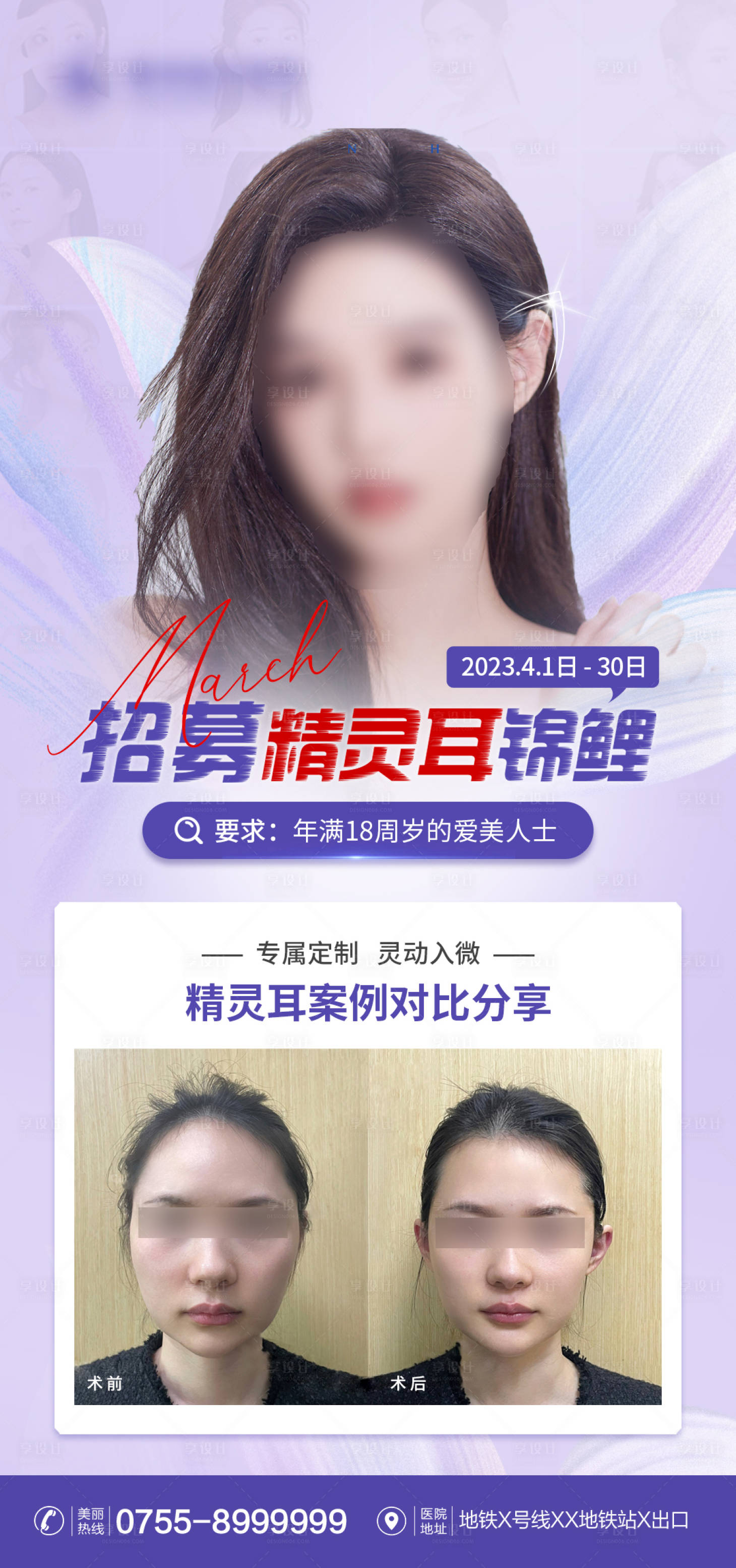 源文件下載【享設(shè)計(jì)】搜索編號：86250015560892064【醫(yī)美精靈耳招募海報(bào)】