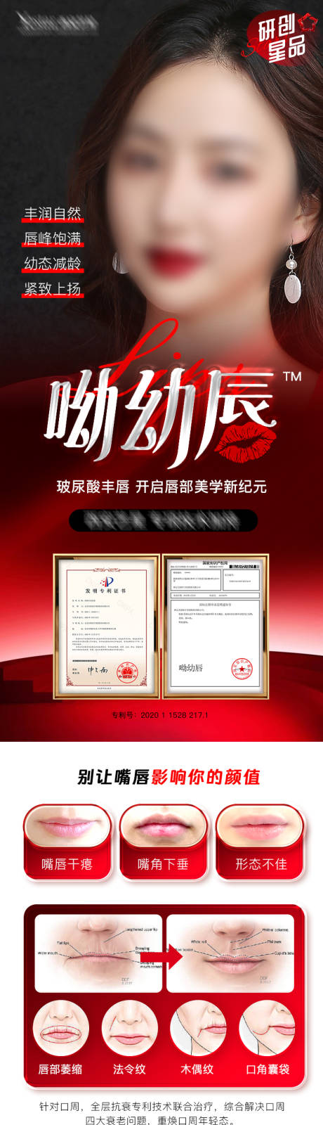 源文件下載【玻尿酸豐唇】編號：71010015570122595