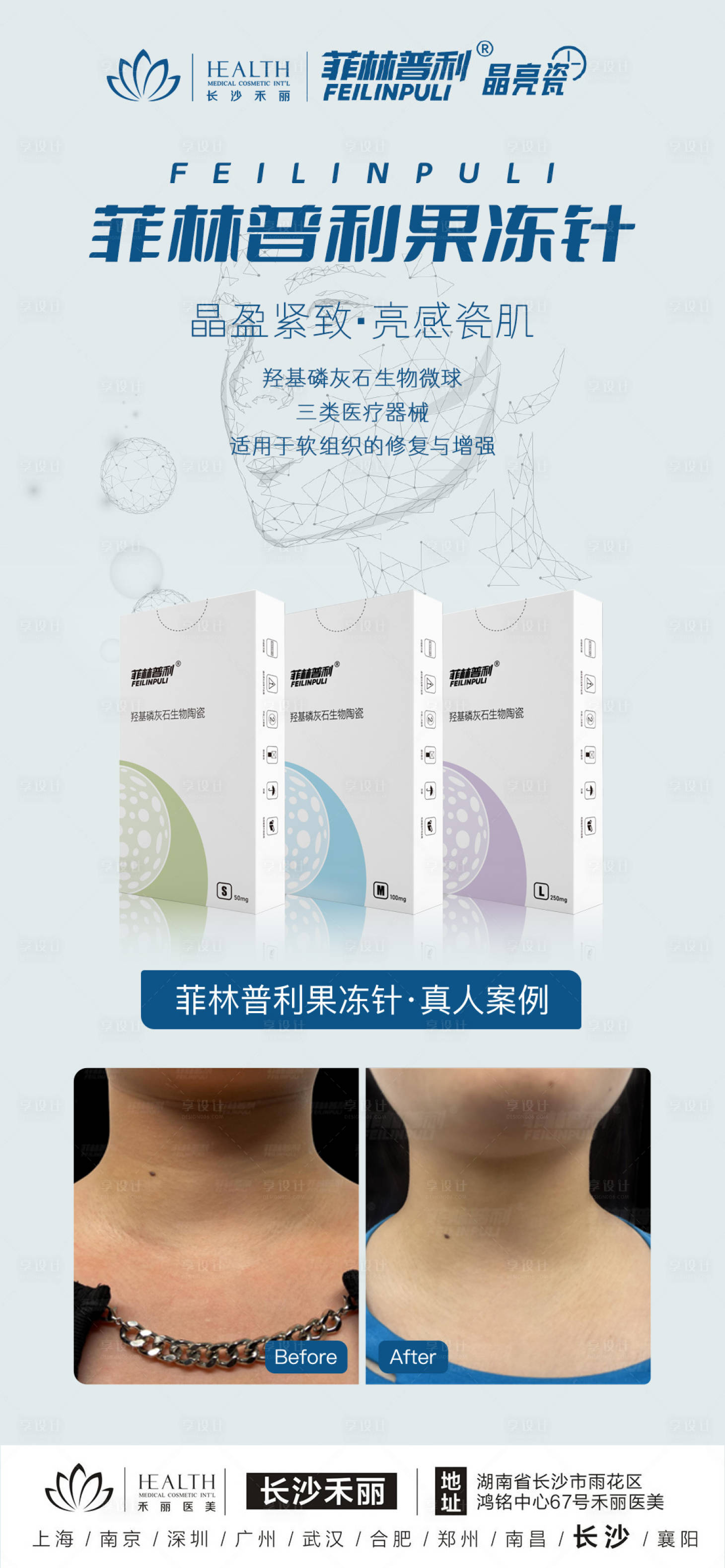 源文件下载【医美-菲林普利果冻针】编号：27210015512631796