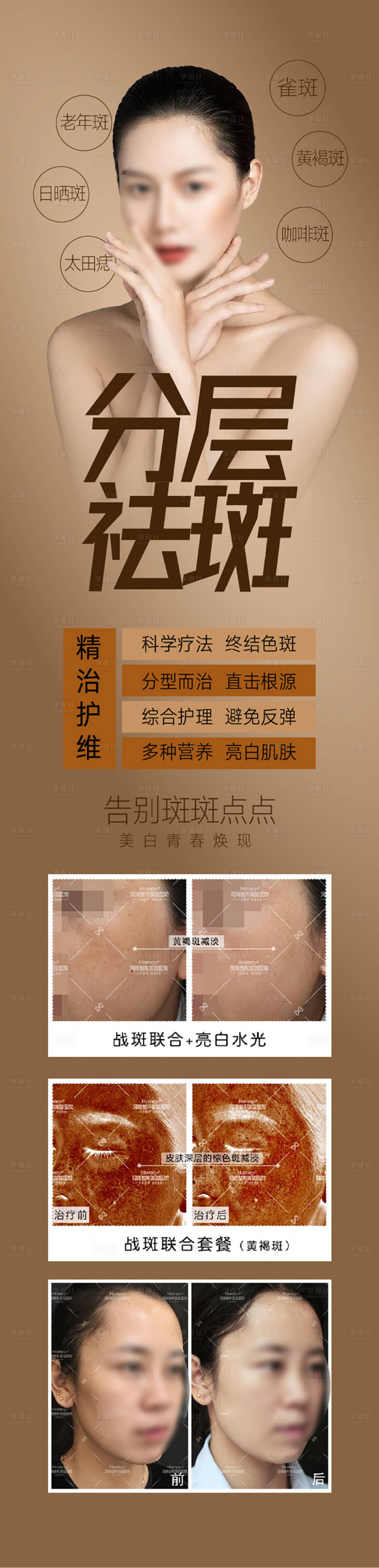 源文件下载【祛斑海报】编号：93290015706147318